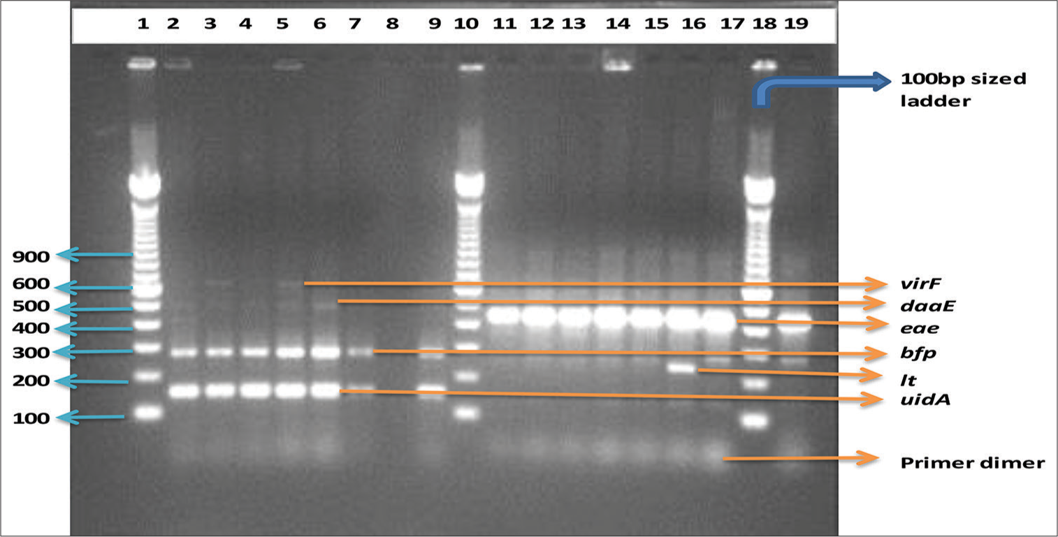 Multiplex PCR gel analysis of diarrhoeagenic E. coli strains from Lagos and some selected reference strains. Lanes 1, 10 and 18 are 100-bp sized ladder; lane 19, bfp and eae positive control while lane 8 is the negative control (PCR grade water)