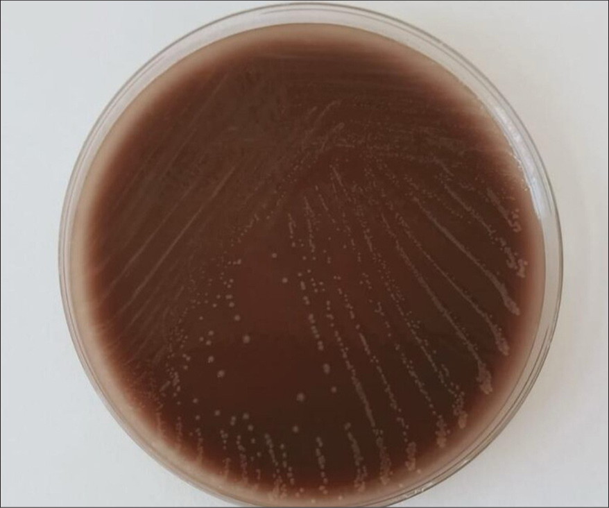 Bone marrow culture showed growth of Neisseria meningitidis on chocolate agar medium.